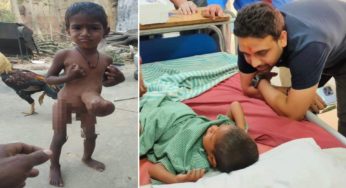 भाजपा प्रदेश प्रवक्ता कुणाल षाड़ंगी के पहल पर ओंफालोसिल से पीड़ित 2 वर्षीय बच्ची के सफल ऑपरेशन के बाद अस्पताल से मिली छुट्टी